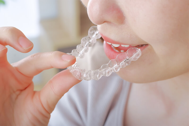 目立ちにくいマウスピース矯正